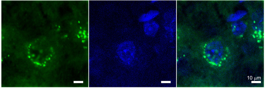 Granule cells and muscarinic receptors illuminated by fluorescent stains