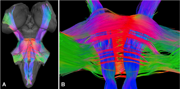 Brainstem tractography reconstruction based on human post-mortem DTI images.