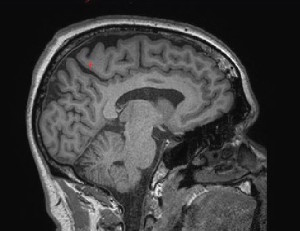 Head MRI